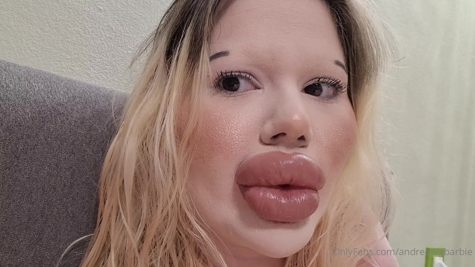 andrea bgbarbie -Biggest lips in the world