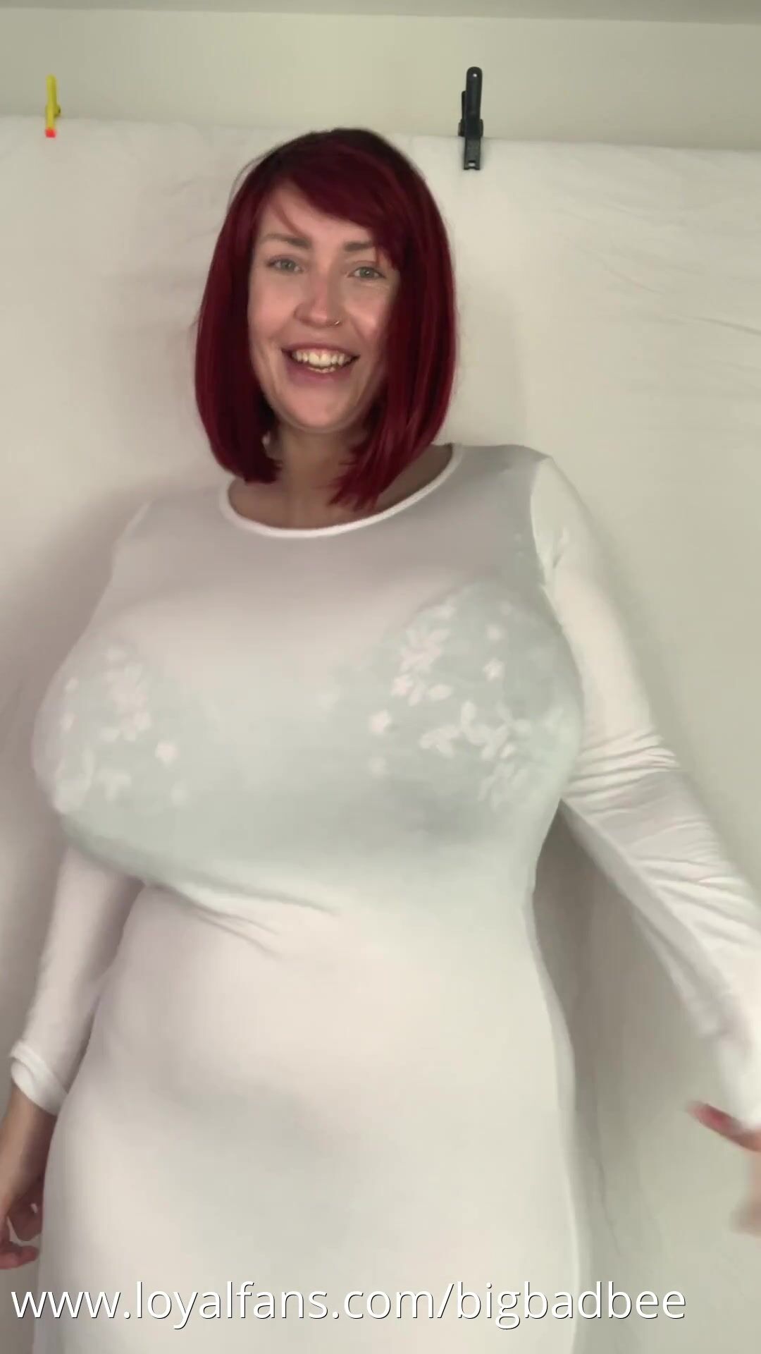 Breast expansion 2